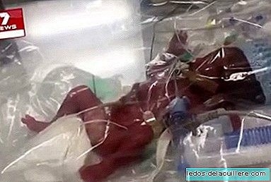 A premature baby of 23 weeks and 760 grams manages to survive thanks to keeping it in a plastic bag with oxygen