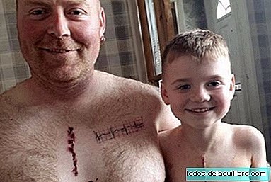 A father tattoos the same scar of his son, operated on the heart, to show him not to be ashamed