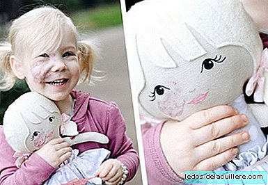 A very special gift: her mother creates a doll just like her to help her normalize her hemangioma