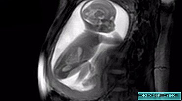 A video shows what the 'ultrasound' will look like in the future