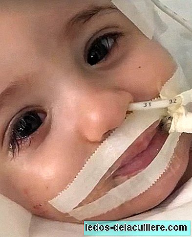 En baby våkner fra koma etter at foreldrene hennes nektet å koble henne fra