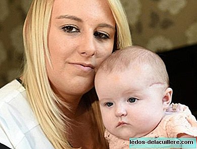 Un bébé a une tête coupée dans sa césarienne et il faut 24 heures pour coudre la plaie.