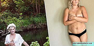 An Australian blogger shows her mother's body to end the pressure to recover her figure