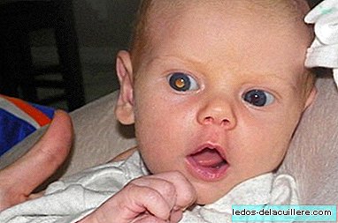 אם מגלה סרטן בעין לתינוקה בזכות תמונות הבזק של הנייד