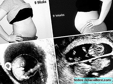 A mother shows in photos the differences between her first pregnancy and the second, of twins
