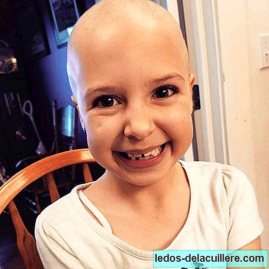 A seven-year-old girl with alopecia wins the "Crazy Hair Day" contest
