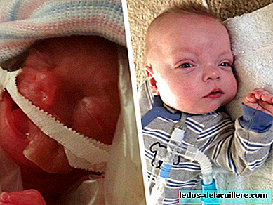 Een van de kleinste baby's ter wereld gaat na 307 dagen in het ziekenhuis naar huis