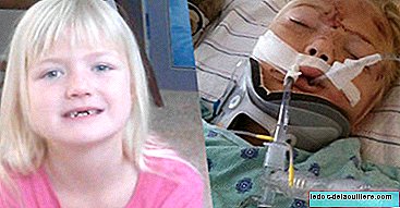 Родители предупреждают о важности использования автокресла: ремень безопасности разрезал живот их 6-летней дочери посередине