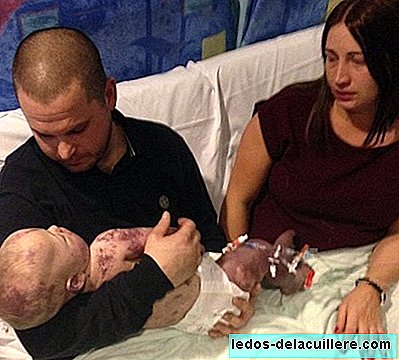 Some parents share the photos of the last day with their baby, before dying of meningitis B
