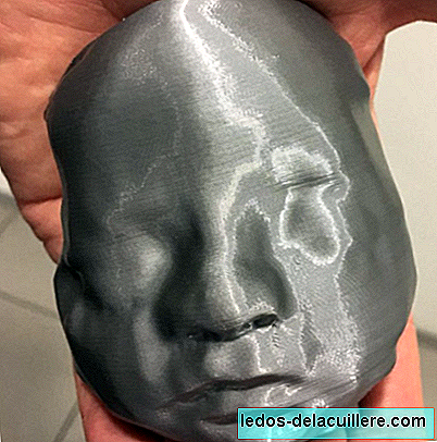 Blind parents know their daughter's face thanks to the 3D printing of an ultrasound