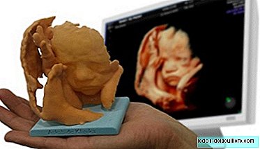 Baby3Dprint: een sculptuur van de foetus van echografie, zou je het willen?