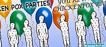 Welcome to the chickenpox party