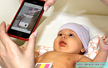 „BiliCam“: mobilní aplikace pro detekci žloutenky u vašeho dítěte