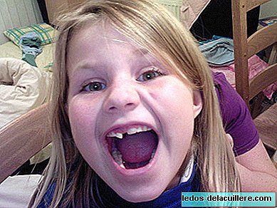 Hvordan skal man opptre mot tann traumer hos barn?