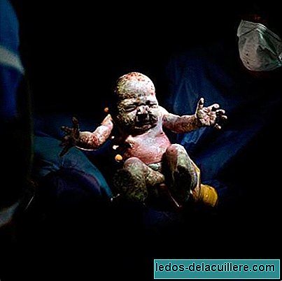 "César", an impressive series of photographs of babies born by caesarean section