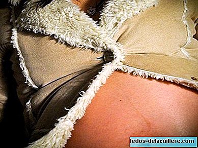 اعتنِ ببشرة المرأة الحامل أثناء البرد
