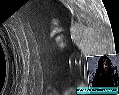 Curious ultrasounds: the emperor of Star Wars