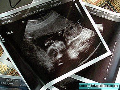 Third trimester ultrasound