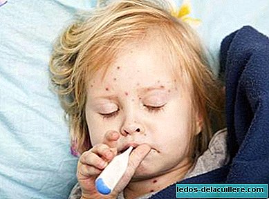 USA alert that there are more and more cases of measles