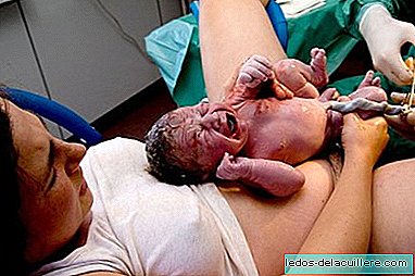 72% av gravida kvinnor skulle be om epidural när de födde