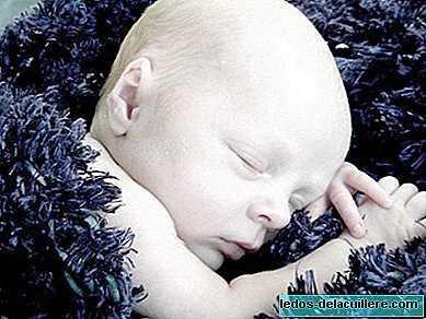 Kasus aneh bayi lahir dengan darah putih
