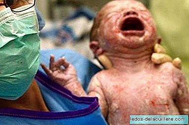 Das Hospital de León wendet ein neues Protokoll an, um unnötige Kaiserschnitte zu reduzieren