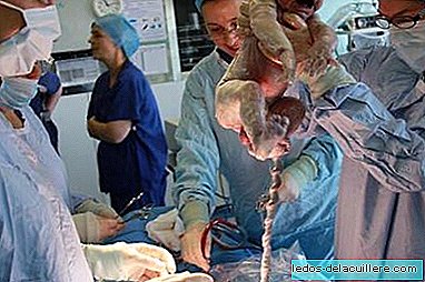 The number of caesarean sections practiced in Spain increases almost 10% in ten years