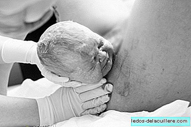 "The birth of the head": shocking series of photos of childbirth when only the baby's head has left