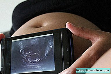 האם רע להשתמש בטלפון הנייד במהלך ההיריון?