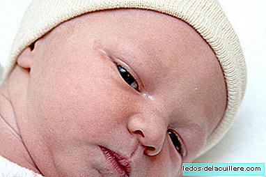 Är det nödvändigt att lägga salva i nyfödda ögon?