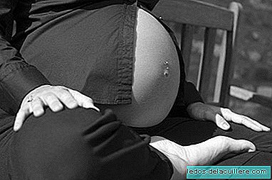 Strije v nosečnosti