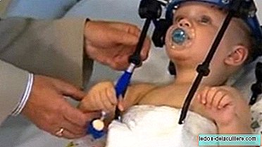 هل يوجد ملاك وصي ؟: أنقذ حياة الطفل من خلال إعادة وضع رأسه بعد حادث سيارة