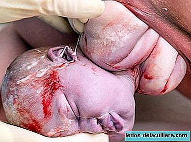 Facebook returns to the streets and censors for "pornography" this photo of a birth