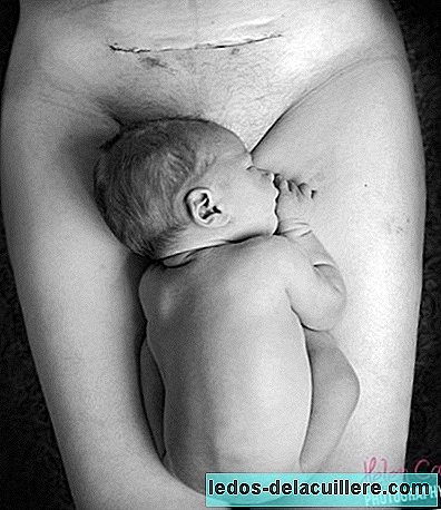 It has happened again: Facebook censures the photo of a baby and the scar of a C-section