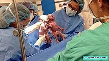 Schokkend: identieke tweelingen worden hand in hand geboren