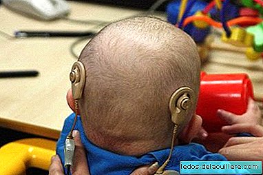 Cochlear implant: what is the treatment?