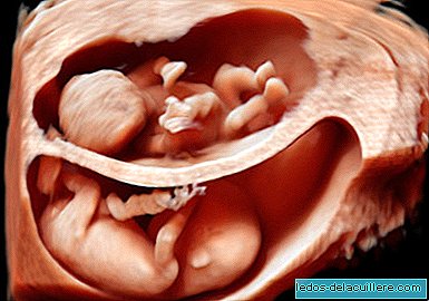 Incredible images that show what the new 3D ultrasound will look like