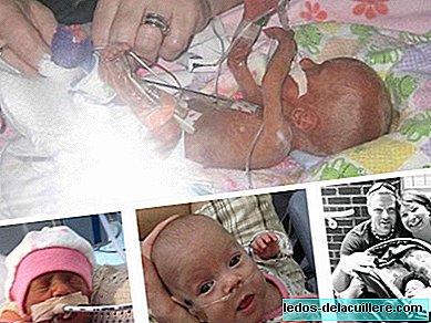 Kenna Claire, the girl who survived after being born with 266 grams of weight