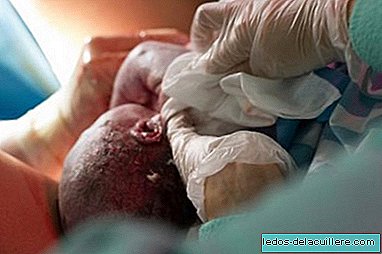 Caesarean section before labor alters the baby's immune response