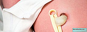 Umbilical brok i babyen: alt hvad du har brug for at vide