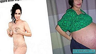 The mother of octillizos poses for a magazine after losing 63 kilos