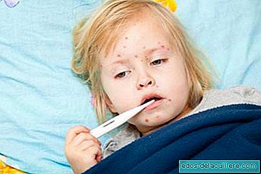Should measles parties not be banned?