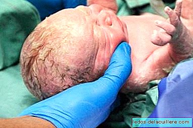 You have a caesarean section without anesthesia to save your child's life