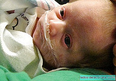 Bebês prematuros teriam que começar a comer aos seis meses de idade corrigida