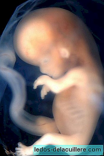 Angeborene Herzfehler können im Frühstadium der Schwangerschaft auftreten