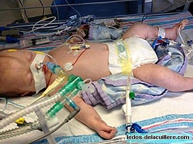 Les parents ont décidé de débrancher leur bébé malade et l'inexplicable s'est passé: il a eu du mal à vivre