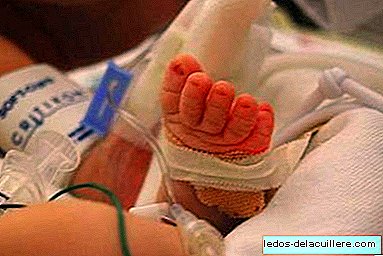 They operate for the first time a premature baby of 1.5 kilos of a congenital heart disease