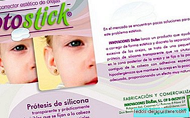 Otostick is an aesthetic concealer with detached ears awarded by the Obra Social “la Caixa”