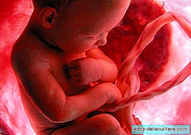 Placenta previa, what is it?