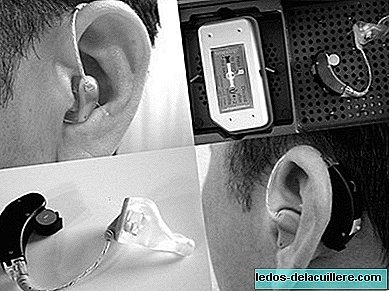 Hearing aids: characteristics and different types